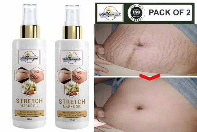 Abhigamyah Present Repair Stretch Marks Removal Natural Heal Pregnancy Breast, Hip, Legs, Mark Oil, 100 ml, Pack Of 2, A-977