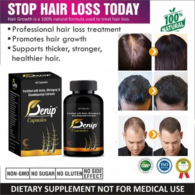 Denip Ayurvedic Amla Bhringraj Sankhpushpi Extracts Hair Growth 60 Pcs Capsules, Pack of 1