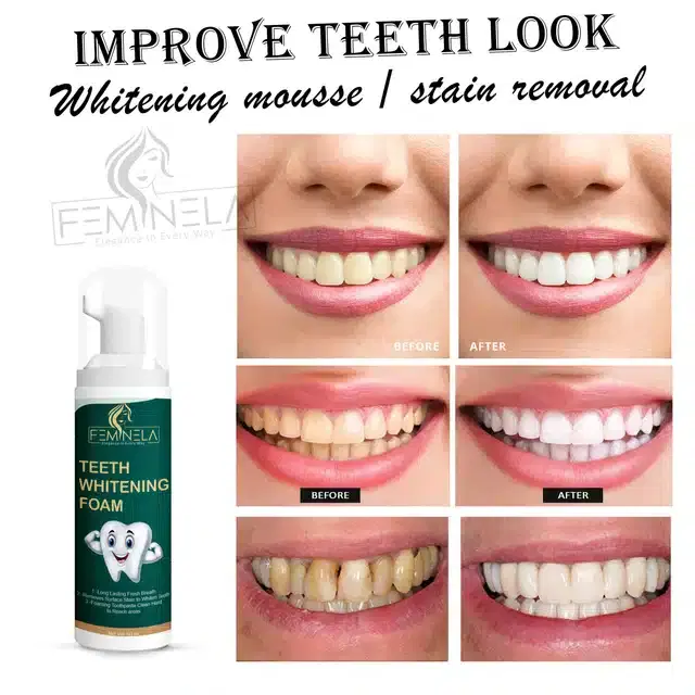 Feminela Teeth Whitening Foam, 60 ml