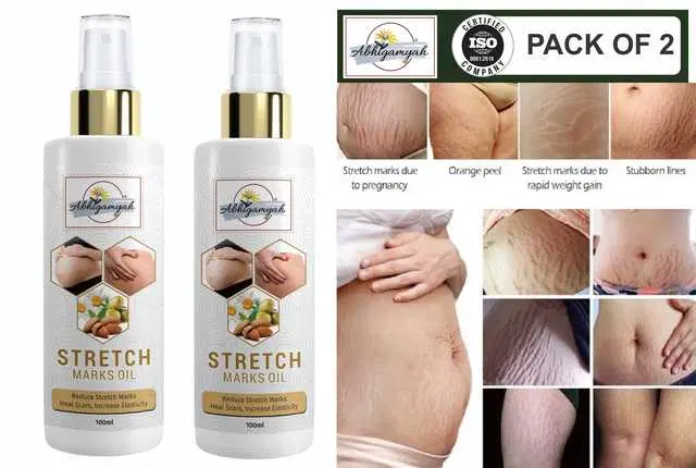 Abhigamyah Present Repair Stretch Marks Removal Natural Heal Pregnancy Breast, Hip, Legs, Mark Oil, 100 ml, Pack Of 2, A-1001
