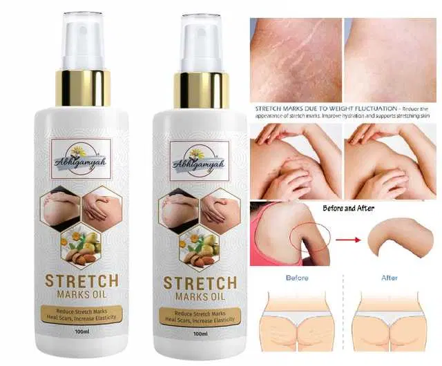 Abhigamyah Present Repair Stretch Marks Removal Natural Heal Pregnancy Breast, Hip, Legs, Mark Oil, 100 ml, Pack Of 2, A-995